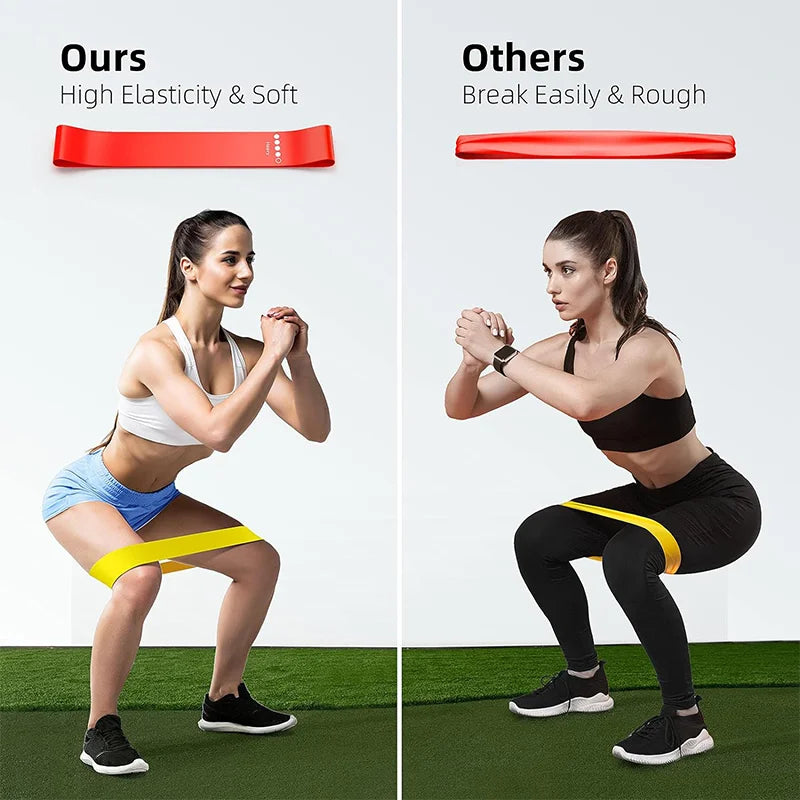Formalife Resistance Loop Bands — Hip & Leg Training Set